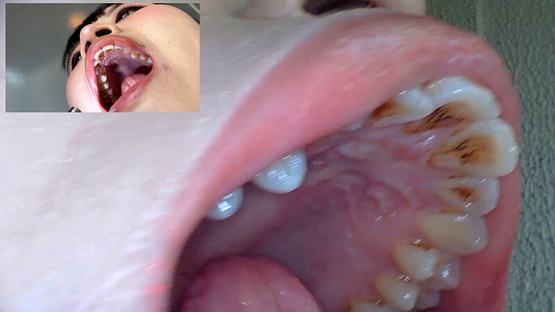 「【素人ナンパ】コールセンター勤務の美人お姉さんに街角で声かけ！口内観察に恥じらう姿が可愛すぎる」のサンプル画像16枚目