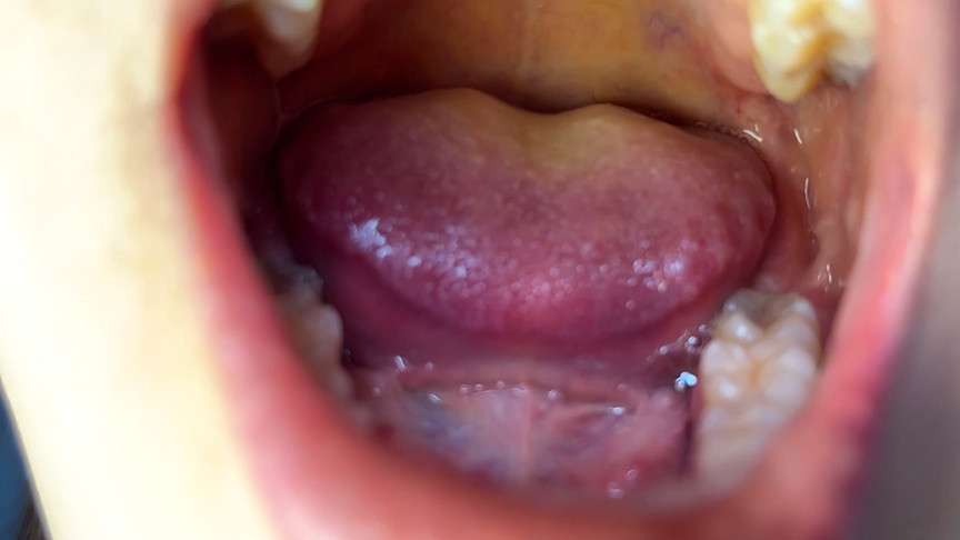 「【素人】街角ナンパで口内観察プレイ！商社営業れなちゃんの歯と舌をじっくり観察【フェチ動画】」のサンプル画像2枚目