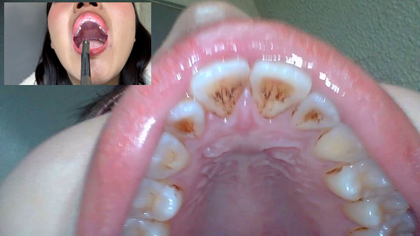 「【あむちゃん】素人コールセンター美女の口内観察プレイ【フェチ動画】街角ナンパ企画」のサンプル画像4枚目