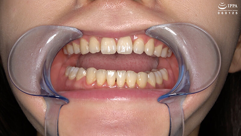 「横峯めぐの口内・歯・のどちんこ観察プレイ!清楚系美少女M女が魅せる貴重映像」のサンプル画像5枚目