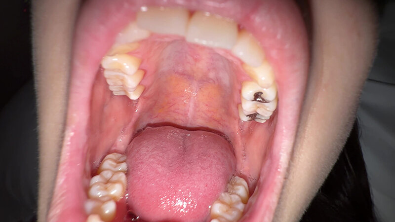 「【個人撮影】湊波流のデカ舌ディープキス＆ツバ鼻吸い」のサンプル画像11枚目