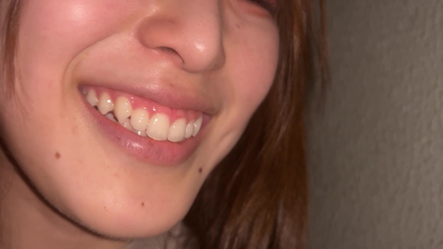 「【素人8名】口腔観察フェチ動画【歯・舌・喉チェック】150分大容量お得セット」のサンプル画像9枚目