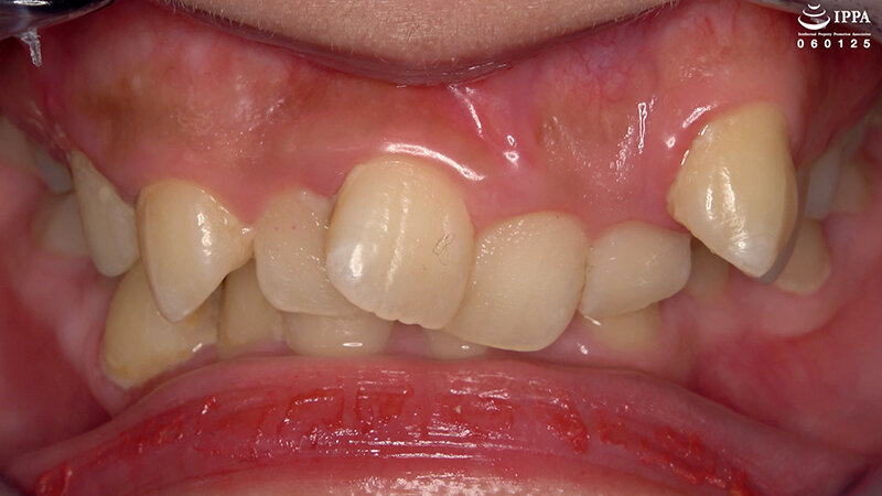 「【相楽さゆな】美少女M女の口内観察&巨大女フェチプレイ|歯・口腔フェチ動画」のサンプル画像3枚目