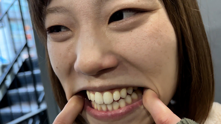 「【口腔観察】歯・舌・喉をじっくり見せる美女4名の口内フェチ動画【お得セット】」のサンプル画像6枚目