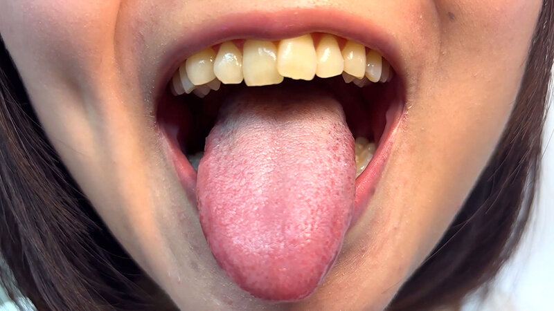 「【素人ナンパ】街角お姉さんみゆりちゃんの口内観察！テレビ局AD美女が恥じらい体験」のサンプル画像7枚目